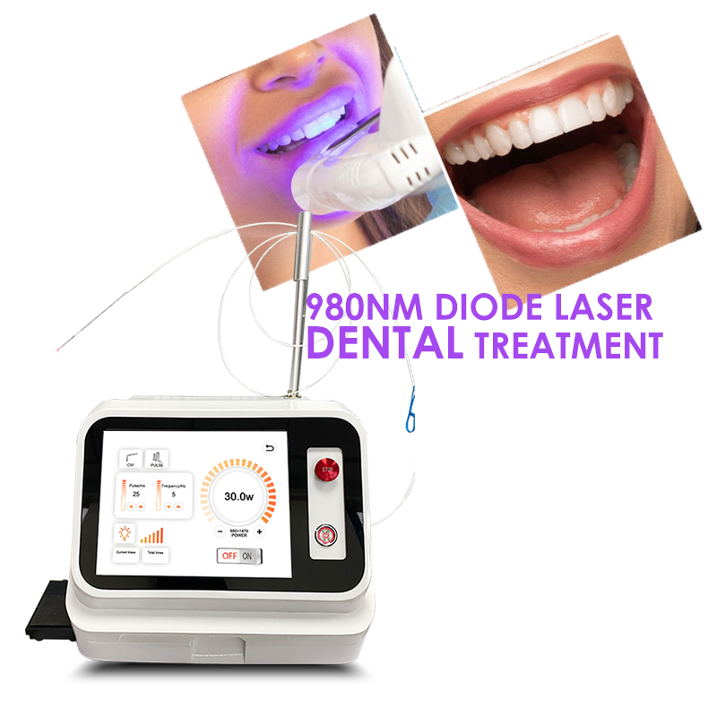 2024 Sıcak Fırsat Diş Yumuşak  - Teeth Whitening With Laser incelemesi ve fiyatı