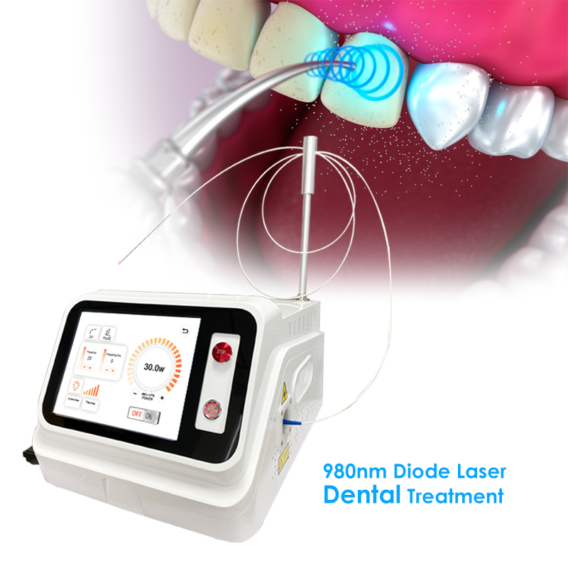 2024 Sıcak Fırsat Diş Yumuşak  - Teeth Whitening With Laser incelemesi ve fiyatı