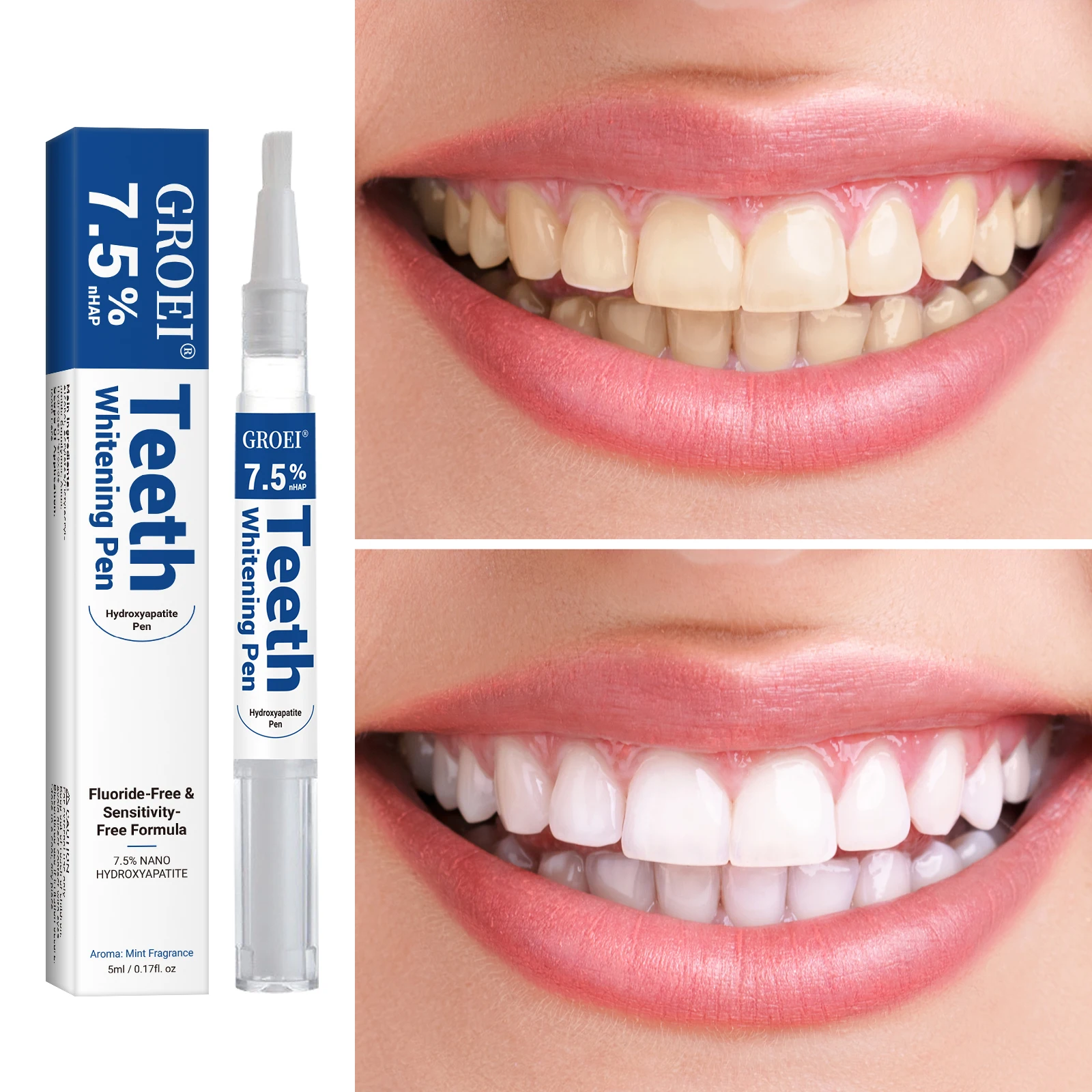 Hidroksiapatit Diş Beyazlatma  - Teeth Whitening Near Me incelemesi ve fiyatı