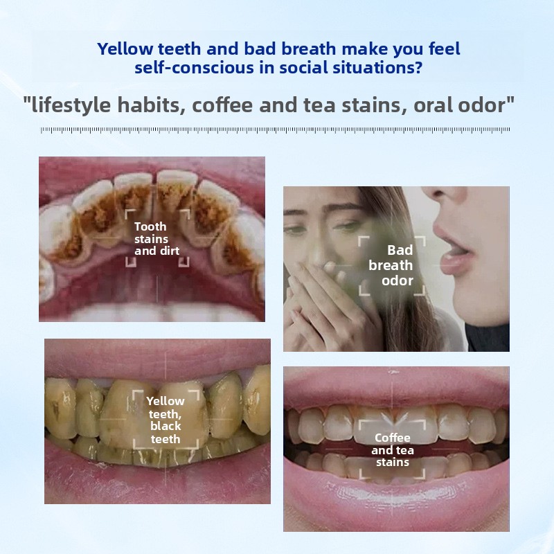 Sağlıklı Dişler ve Diş Eti Kor - Teeth Whitening Enzymes incelemesi ve fiyatı