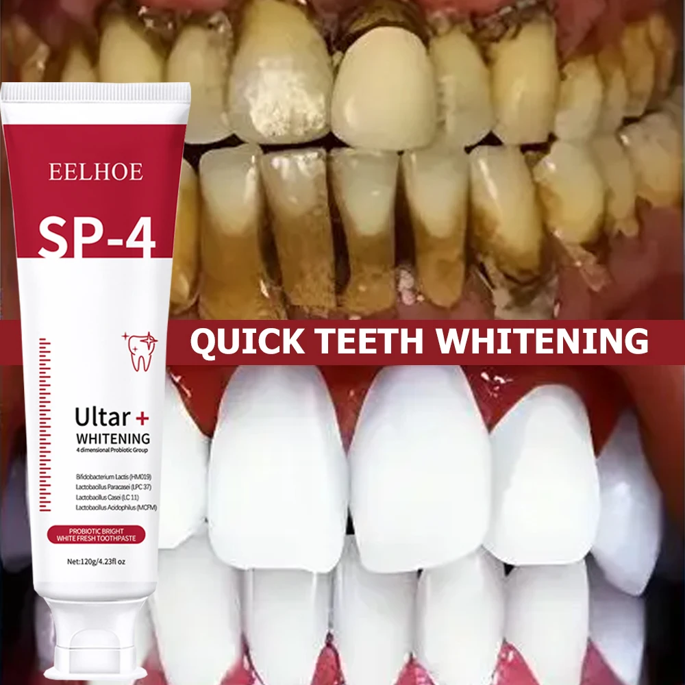 5 adet Sp-4 120g probiyotik be - Teeth Whitening Enzymes incelemesi ve fiyatı