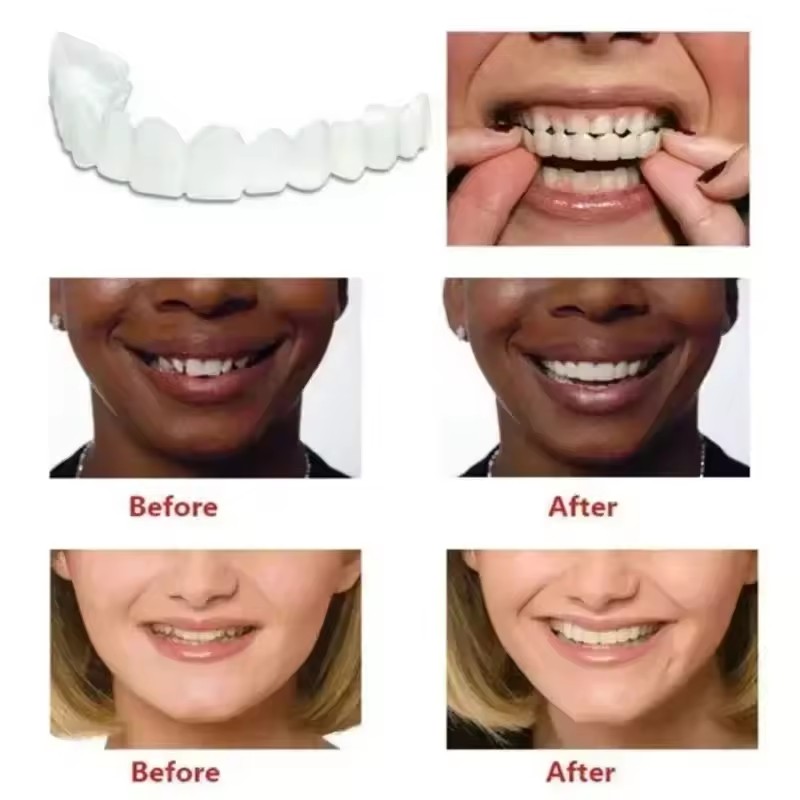 Diş Kaplamaları Beyazlatma Pro - Teeth Whitening Session incelemesi ve fiyatı