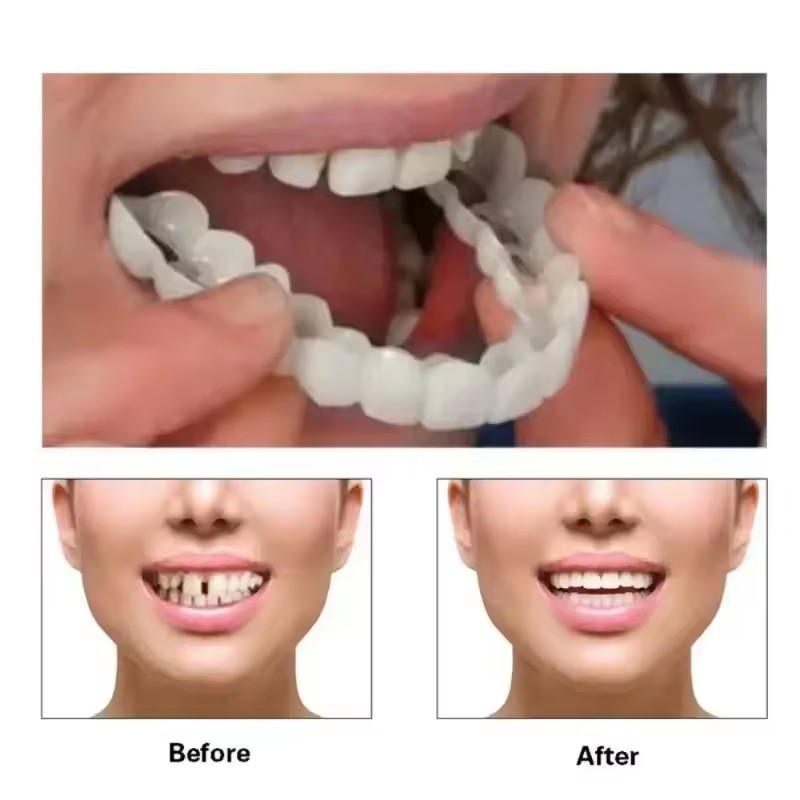 Diş Kaplamaları Beyazlatma Pro - Teeth Whitening Session incelemesi ve fiyatı